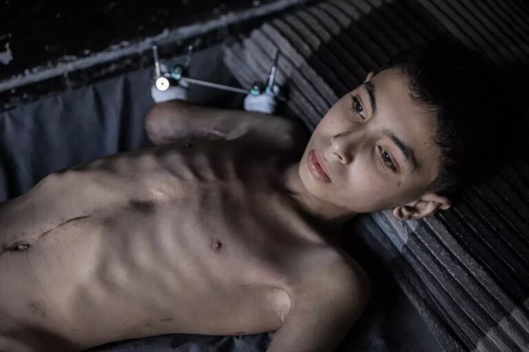 semirin umudu yeniden hayata donmek 2vvemKbE