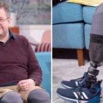 kendi bacaklarini kesen cerrah dolandiriciliktan hapse atildi lCN8JLXw